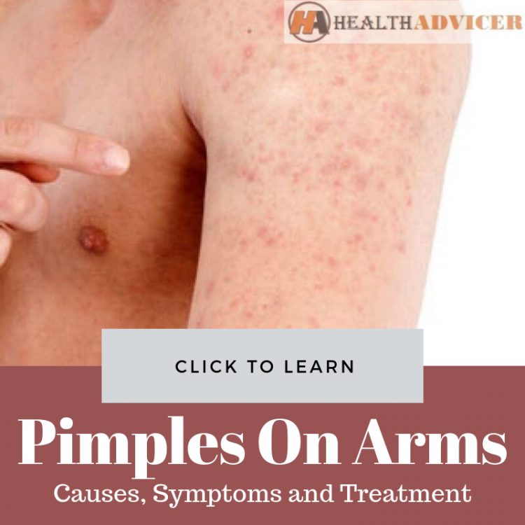 Pimples On Arms