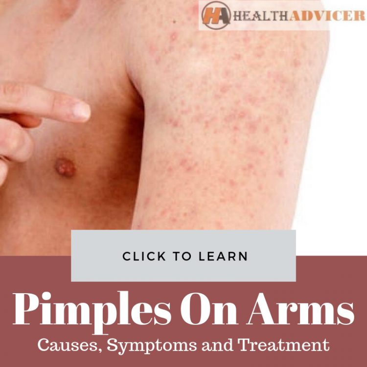 Pimples On Arms: Causes, Picture, Symptoms And Treatment