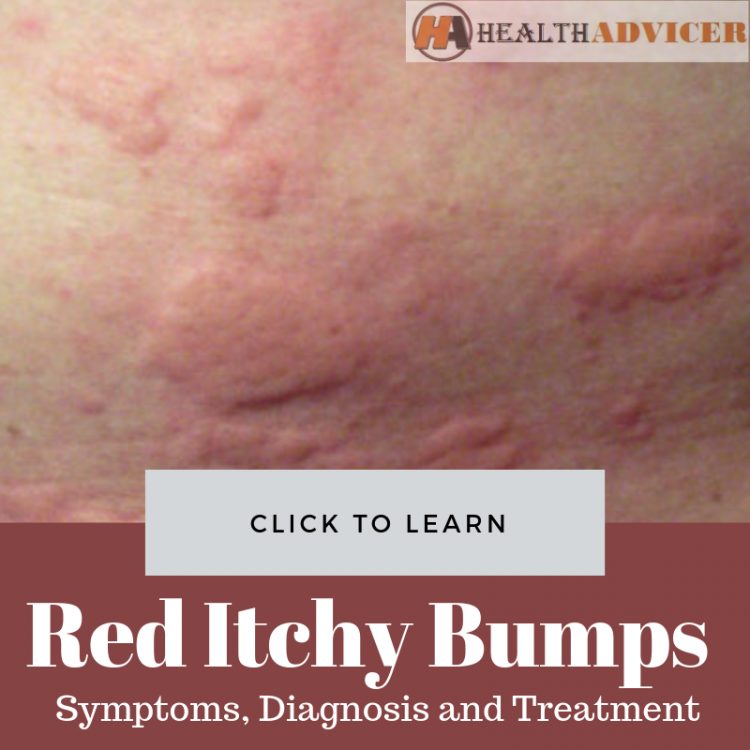 Red Itchy Bumps On The Skin
