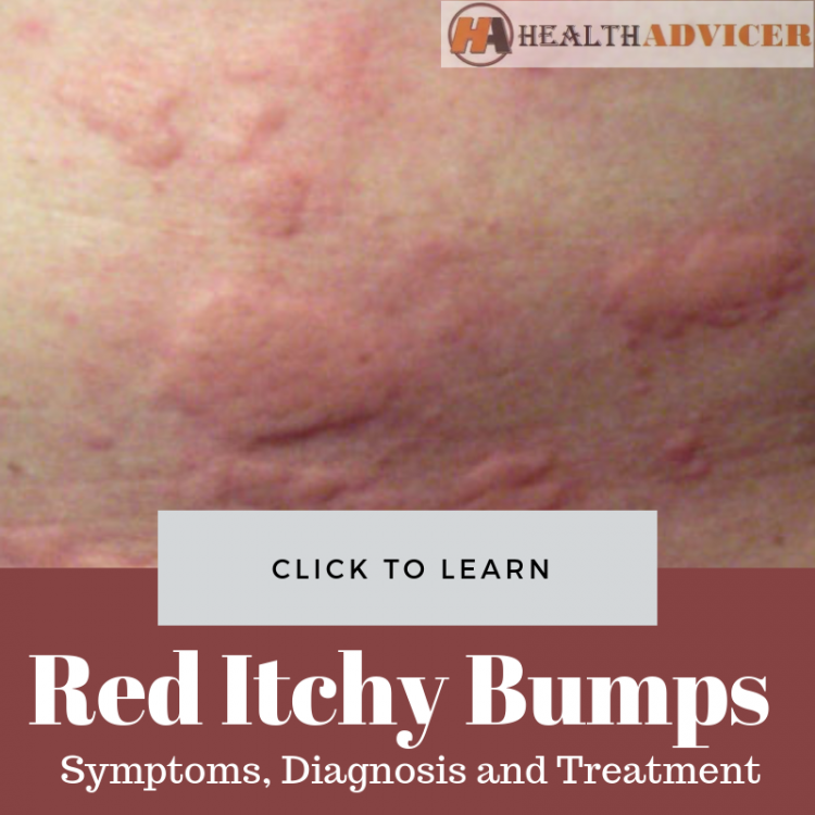 Red Itchy Bumps On Skin Causes Treatment Pictures Minhhai2d Help