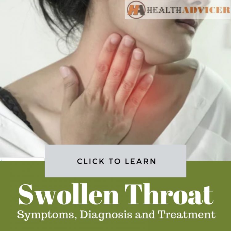Swollen Throat And Difficulty In Swallowing