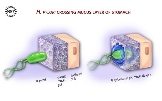 A Bacterium Infection