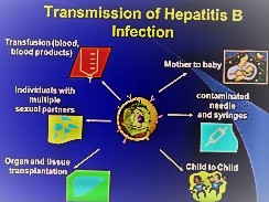 Hepatitis B