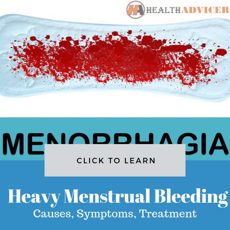 menorrhagia-heavy-menstrual-bleeding