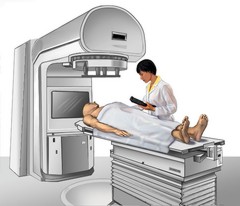 External Radiation Therapy