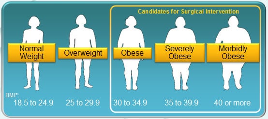 Weight loss surgery