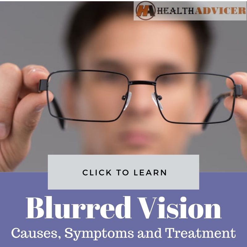 Blurred Vision Causes Treatment