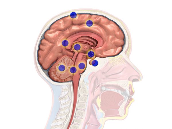 Causes Of Brain Cancer