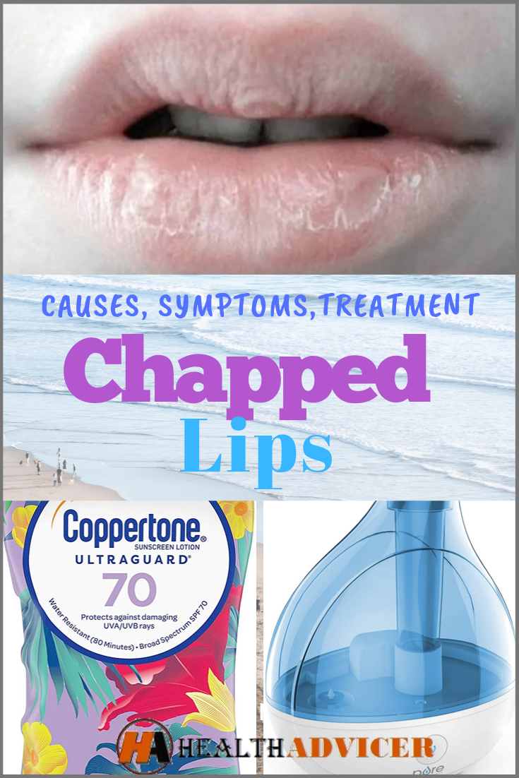 Chapped Lips: Causes, Picture, Symptoms and Treatment