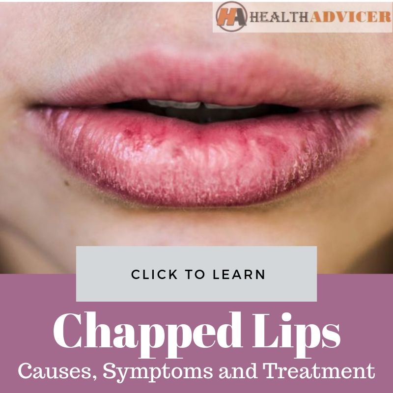 Chapped Lips