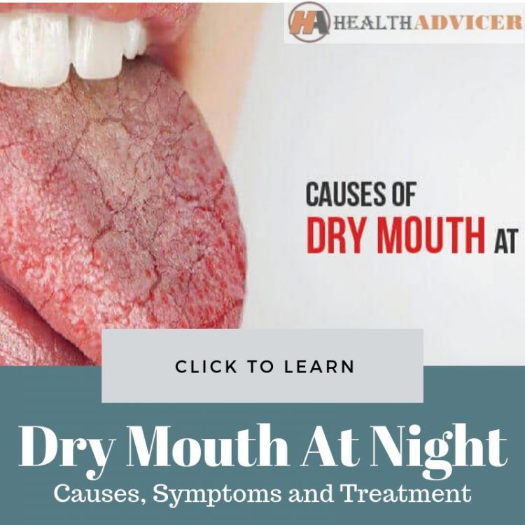 Dry Mouth At Night Causes Treatment