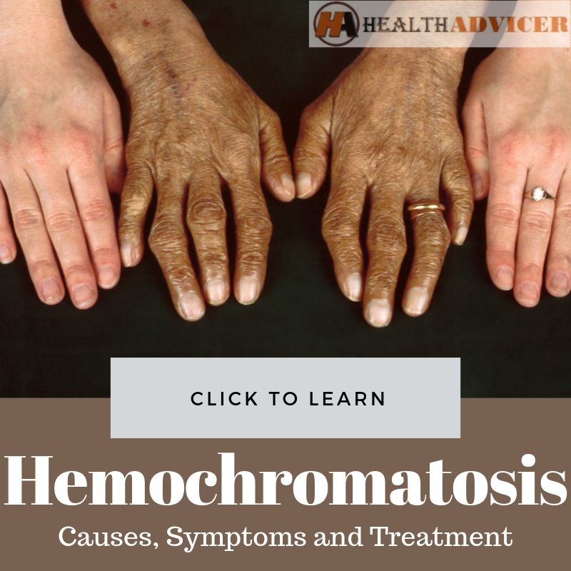 Hemochromatosis: Causes, Picture, Symptoms and Treatment