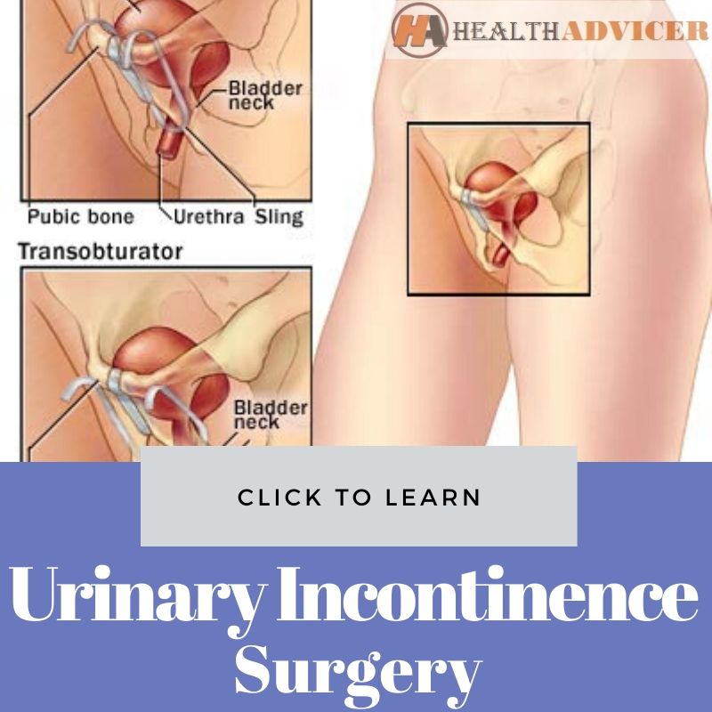 Urinary Incontinence Surgery
