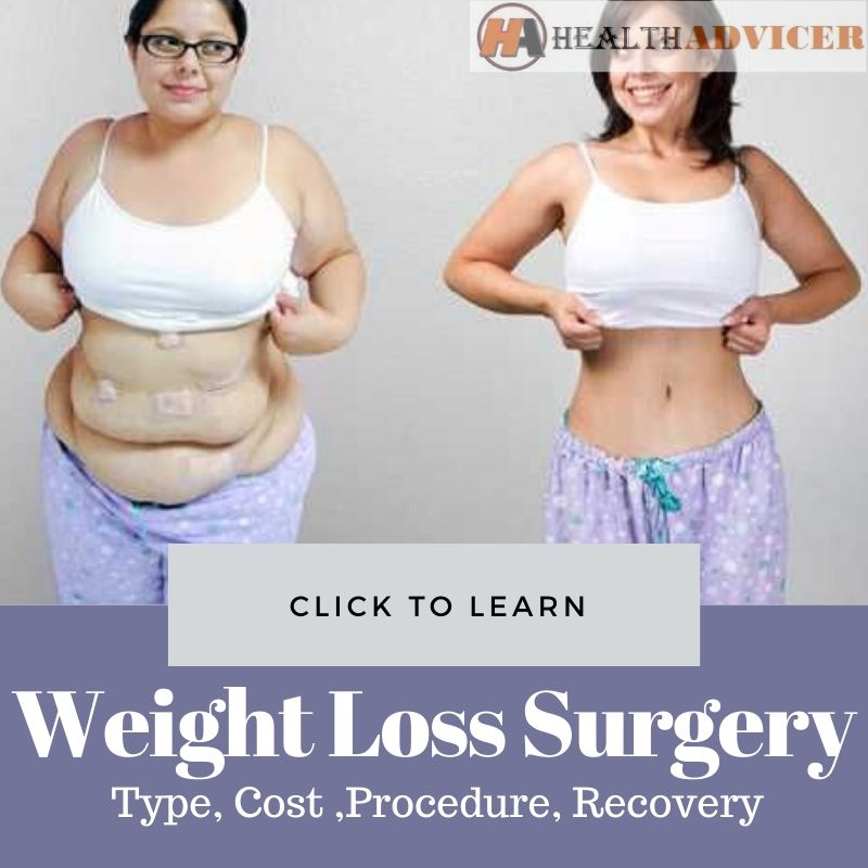 Weight Loss Surgery