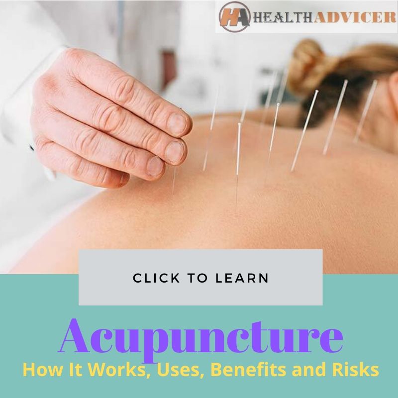 Acupuncture Pictures