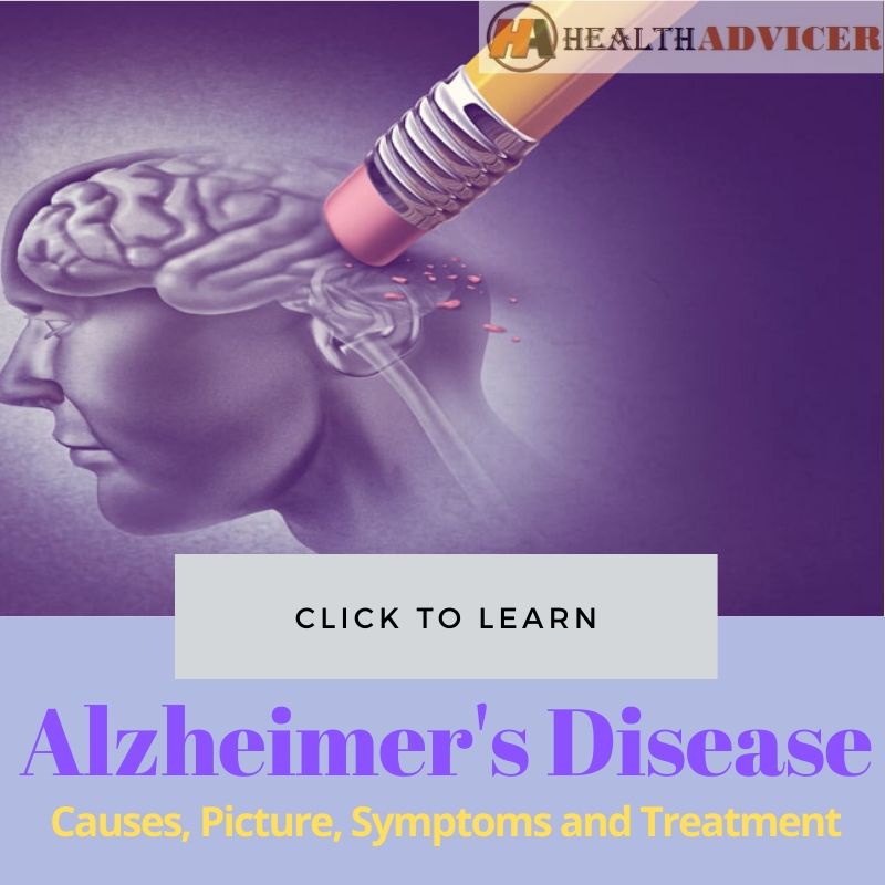 Alzheimer Disease Picture