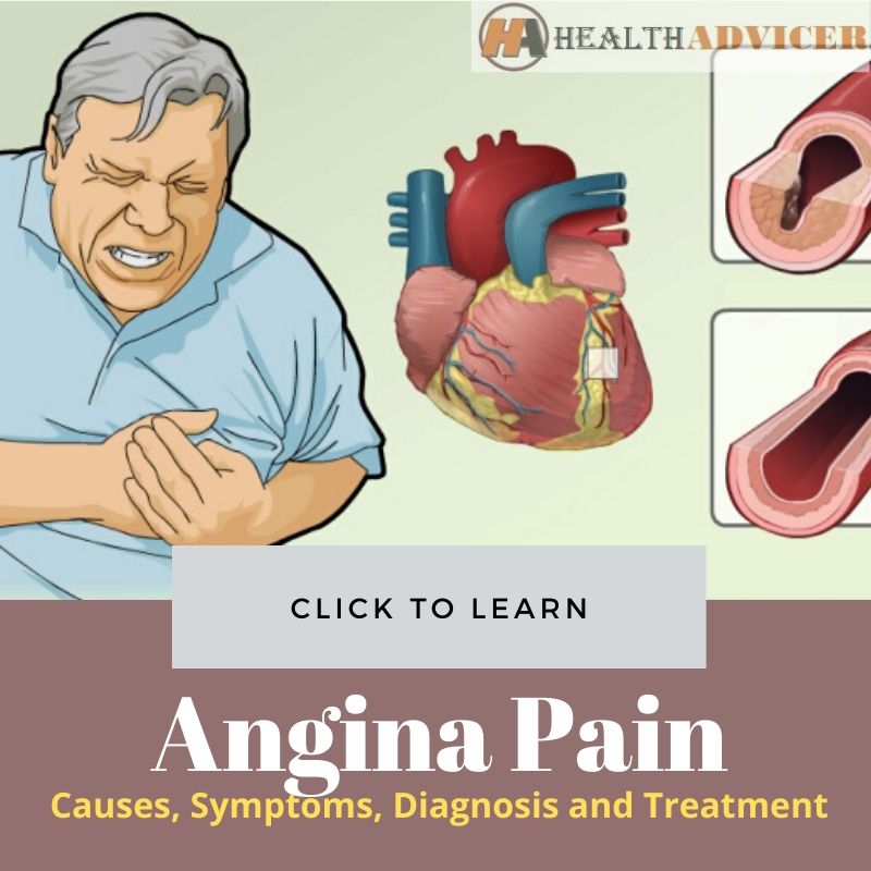 Angina