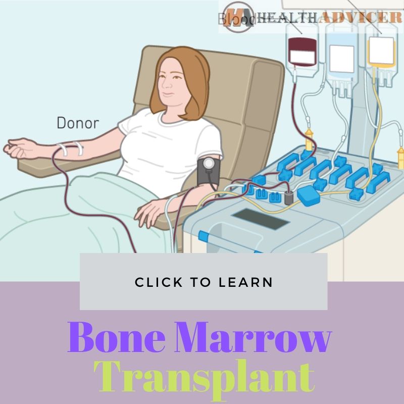 Bone Marrow Transplant