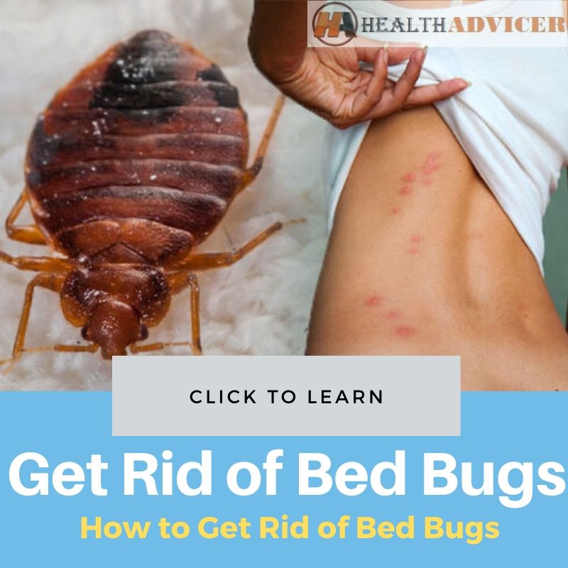 How to Get Rid of Bed Bugs