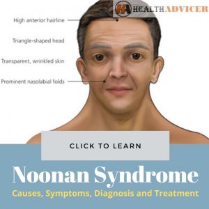Noonan Syndrome Chart