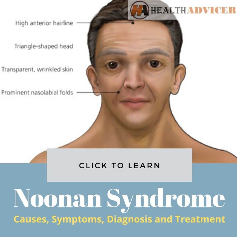 Noonan Syndrome