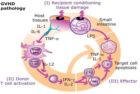 Graft-Versus-Host Disease