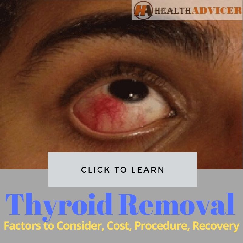 Thyroid Removal Surgery