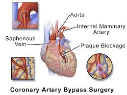 Surgical Procedures