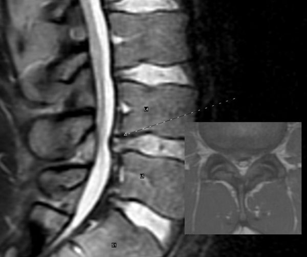 CT scans/ MRI Scans