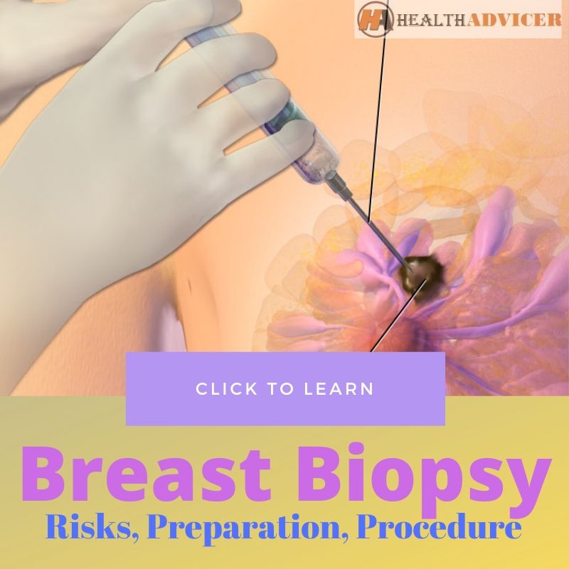 Breast Biopsy for Breast Cancer