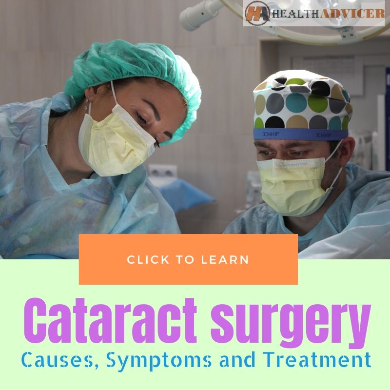 Cataract surgery