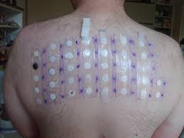 Patch Test