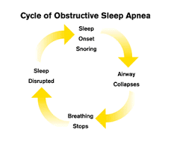 Sleep apnea