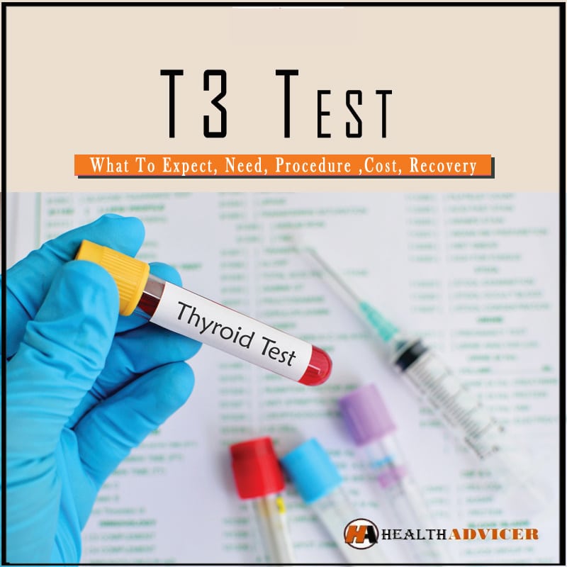 T3 Test What To Expect, Need, Procedure ,Cost, Recovery