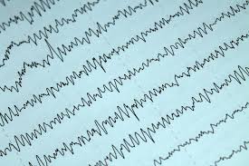 Electrophysiology