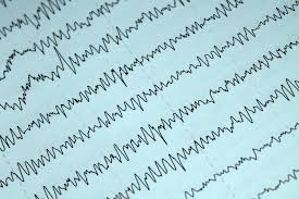 Electrophysiology