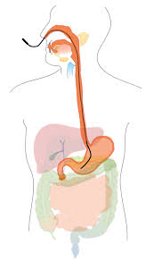 Nasogastric Feeding