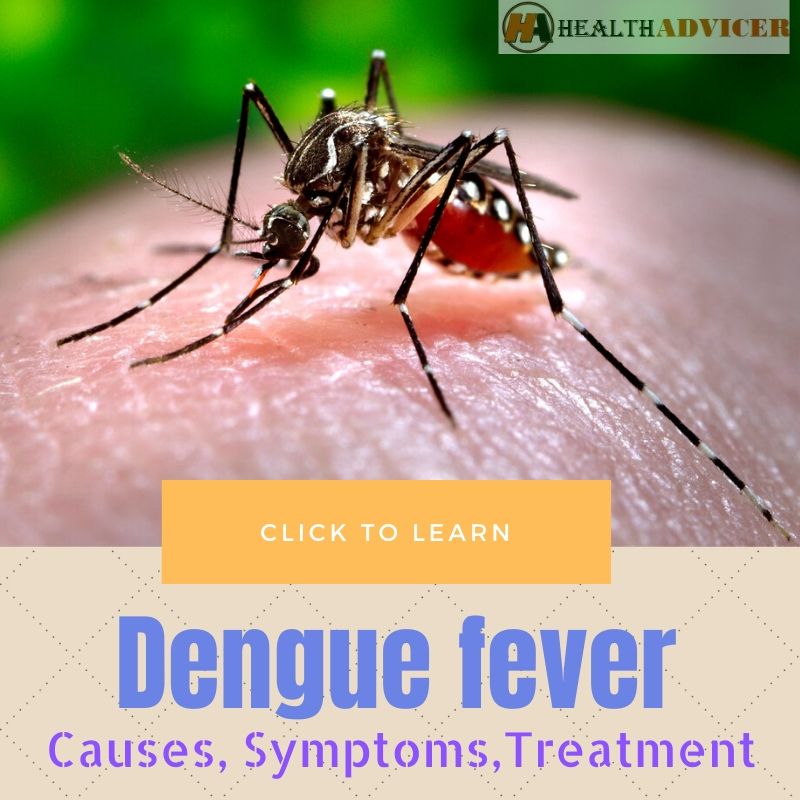 Dengue Fever