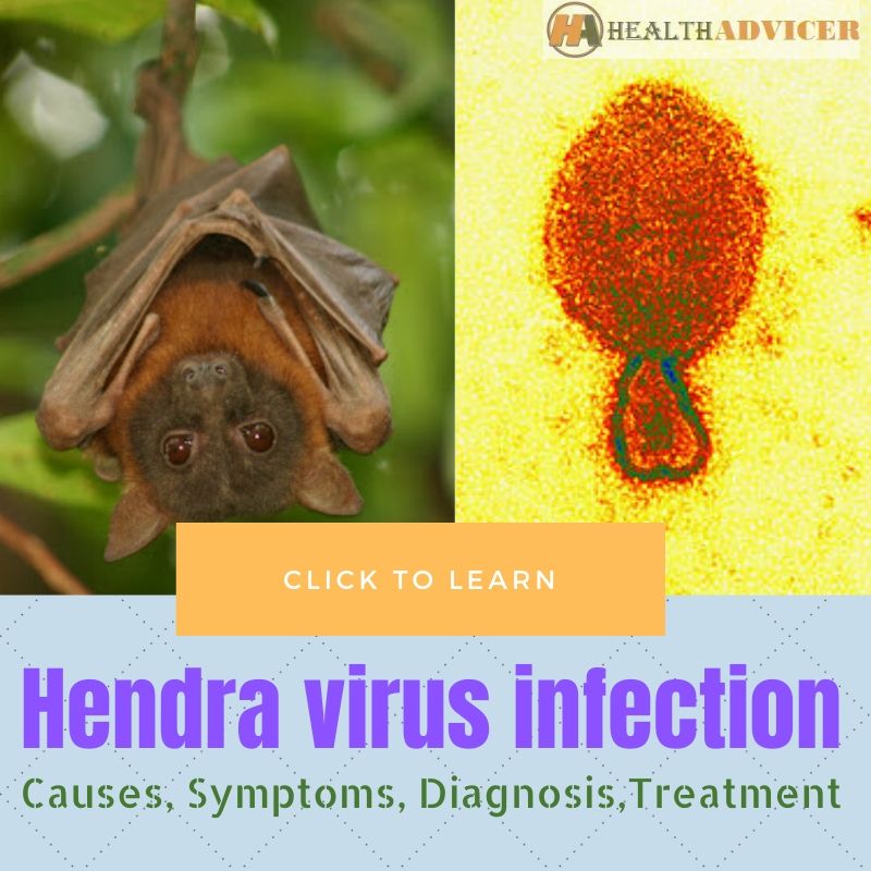 Hendra Virus Infection