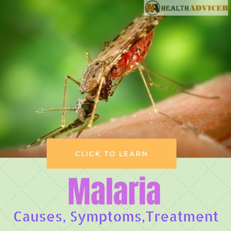 Malaria Causes Treatment