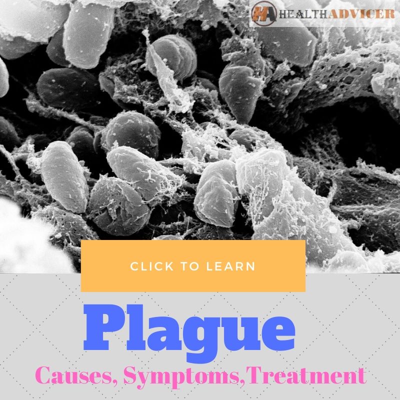 Plague