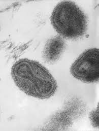 Smallpox Virus