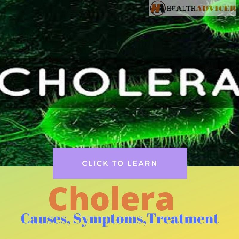 Cholera Causes Treatment