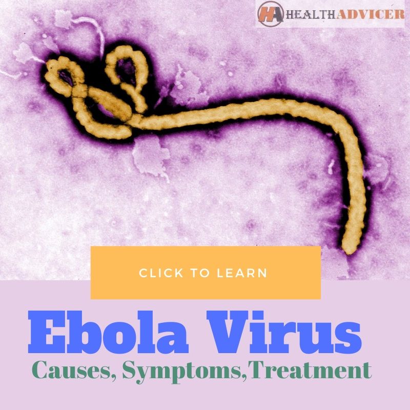Ebola virus disease