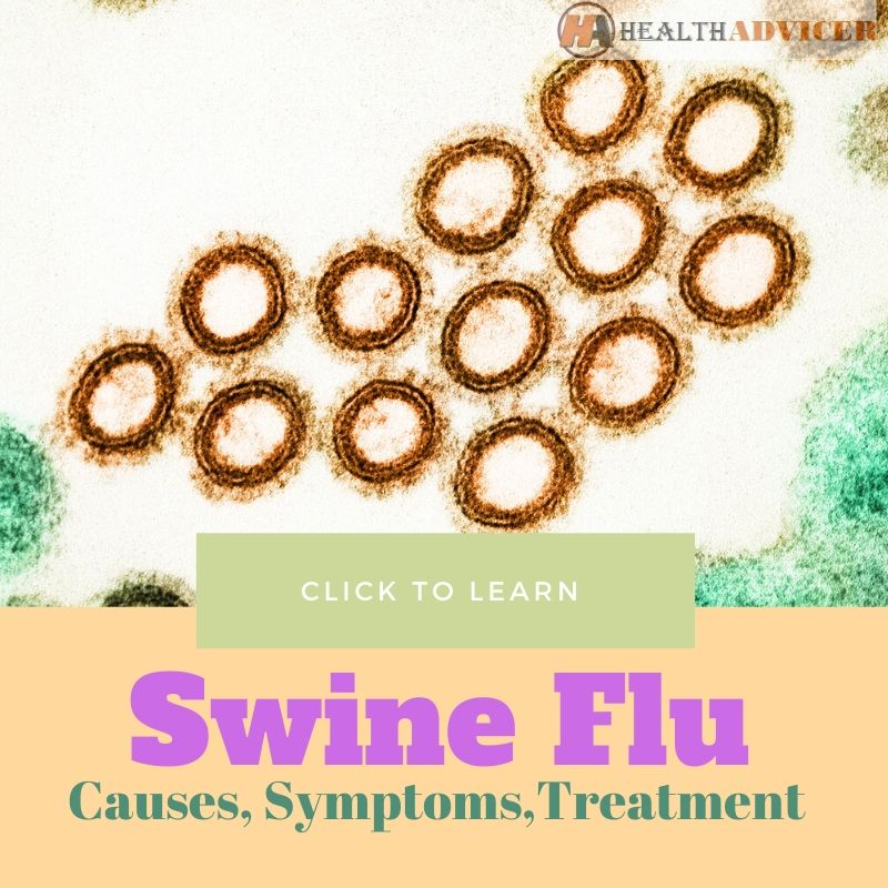 H1N1 Flu Virus Swine Flu