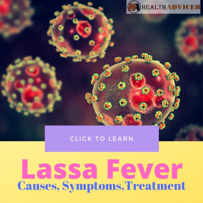 Lassa Fever