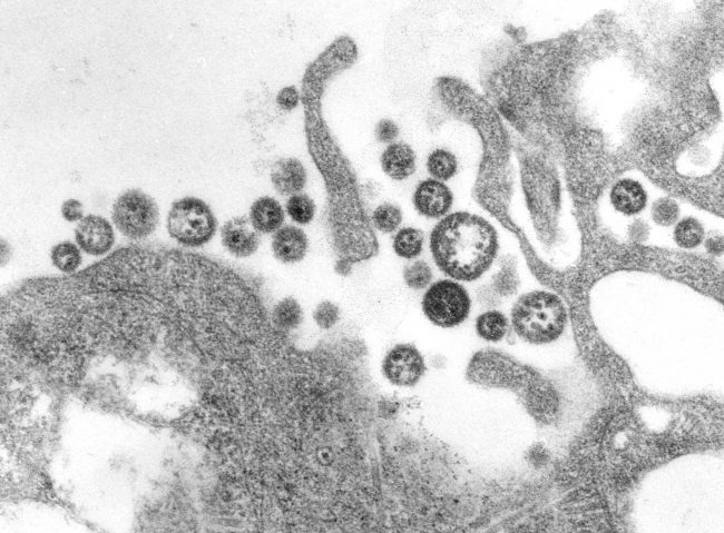 Causes Of Lassa Fever