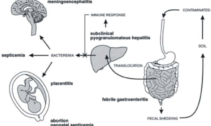 Listeria Infection