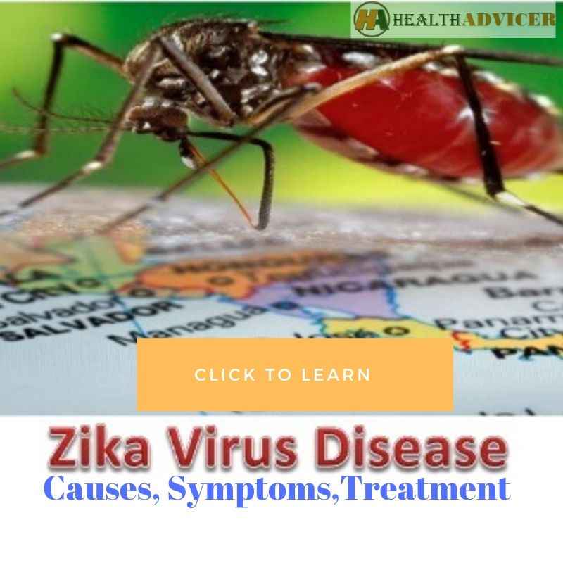 Zika Virus Disease