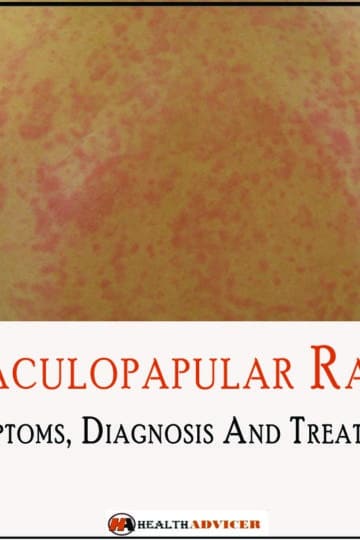 Maculopapular Rash